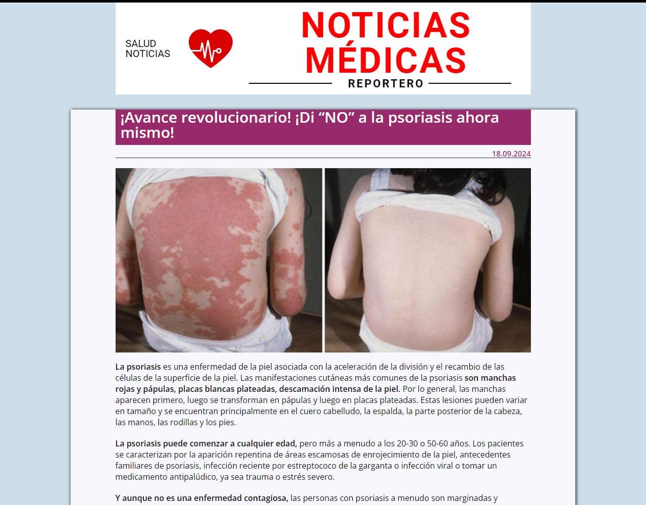 Psoriaderm 1