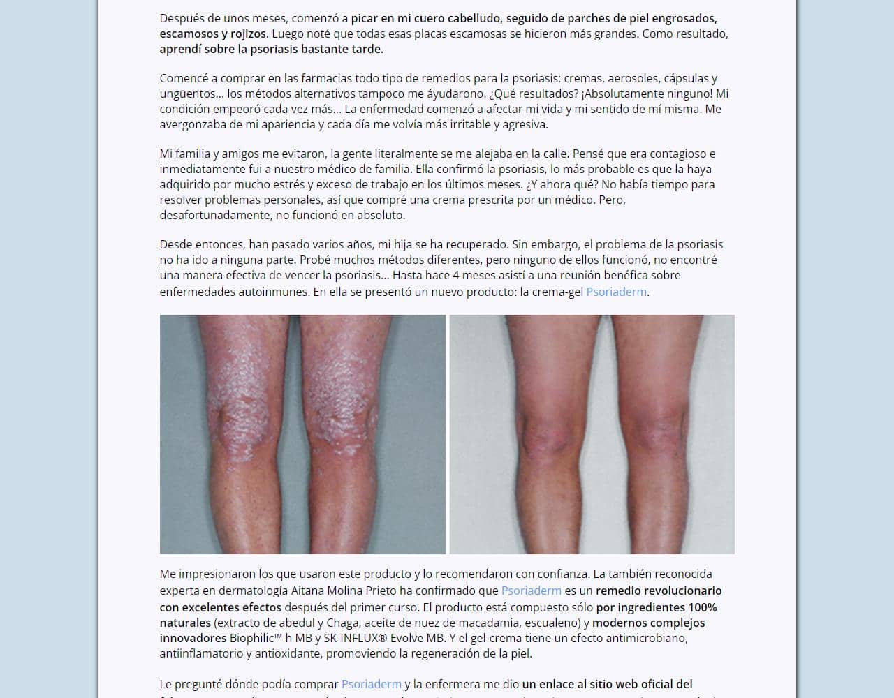 Psoriaderm 3